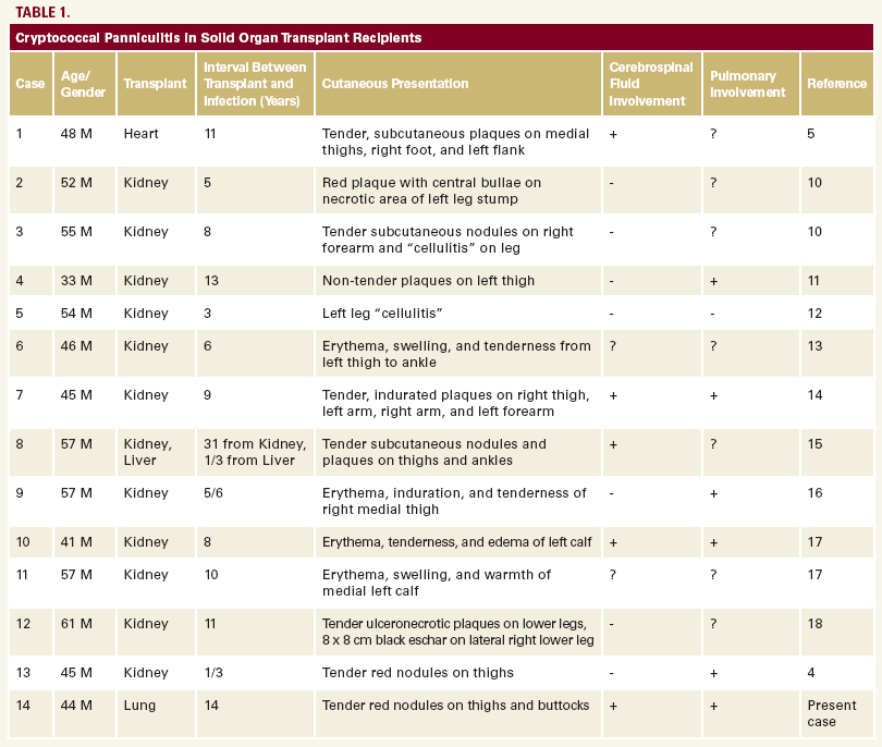 table 3